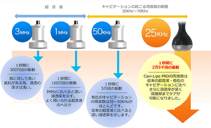 従来の超音波との比較