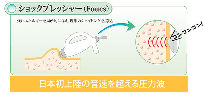 ショックプレッシャー