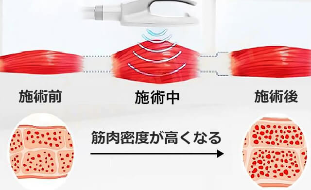 MAGSHAPE（マグシェイプ)の効果