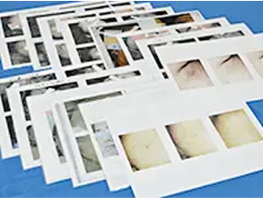 臨床データイメージ画像