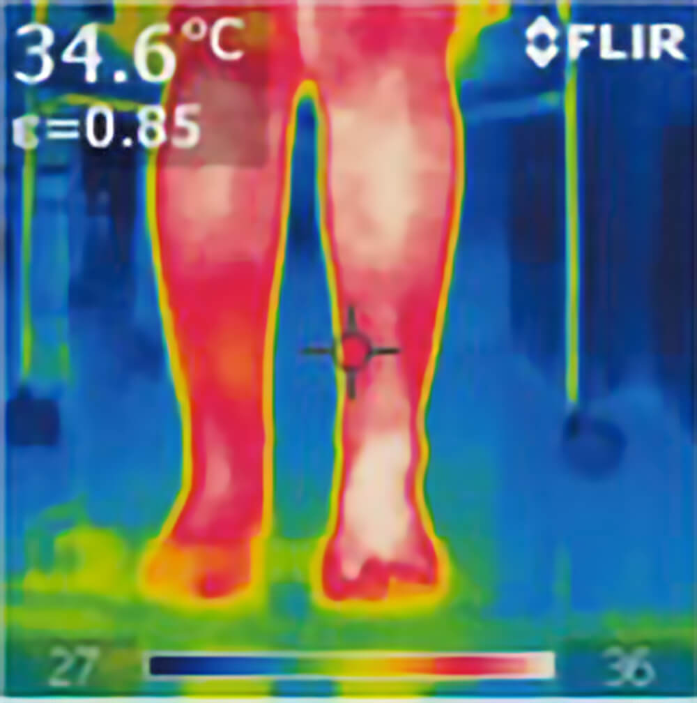 リンパドレナージュ　ハイソックス　Slim520 検証結果　サーモグラフィーで撮影