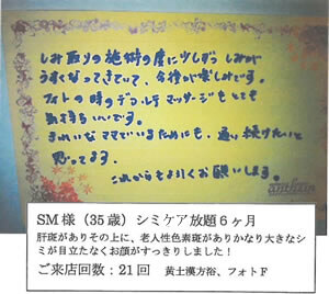 SM様(35歳)シミ取り放題6ヶ月